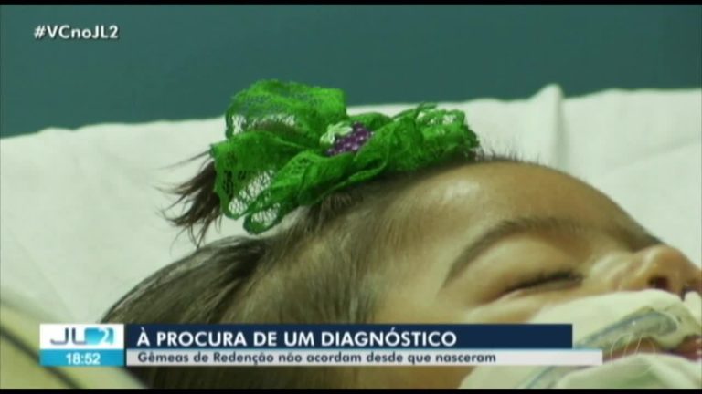 Caso raro de gêmeas que dormem desde que nasceram há 6 meses intriga médicos em Redenção, no PA