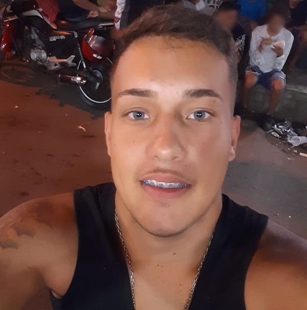 Jovem é incendiado pela ex-namorada no Cachambi, na Zona Norte, afirmam familiares