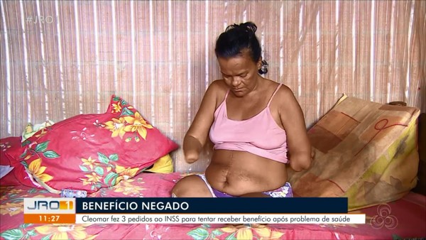 Mulher sem mãos e pernas tem pedido de benefício negado pelo INSS por não poder assinar papel, em RO