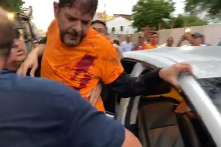 Senador Cid Gomes é baleado durante protesto no Ceará