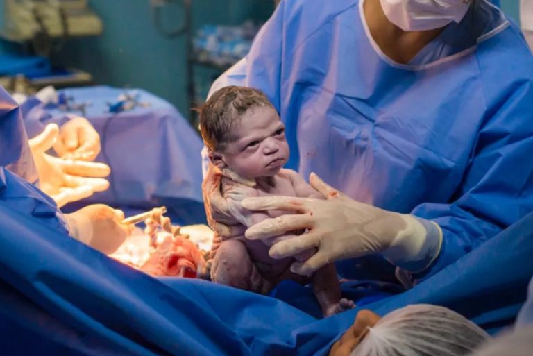 Bebê nasce zangada e foto viraliza na internet