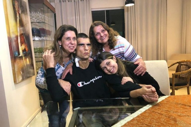 Cervejaria Backer: vítima que não move o rosto pede justiça após alta