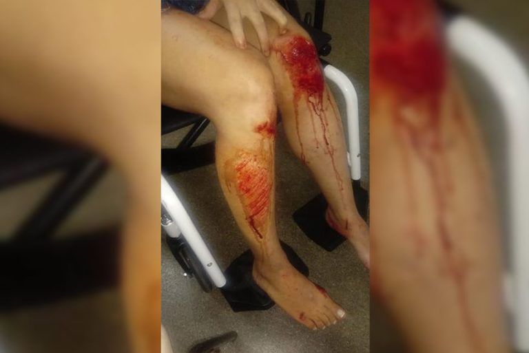 Jovem que pulou de carro para não ser estuprada: “Pior dia da minha vida”