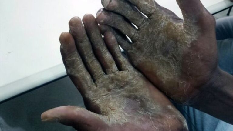 Empregadora é condenada por manter mulher em trabalho doméstico análogo à escravidão por 35 anos na Bahia
