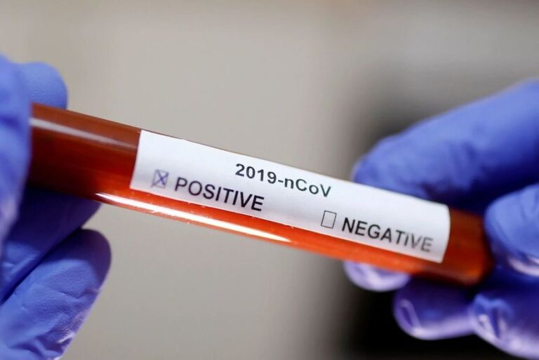 Brasil volta a ter mais de 1.000 mortes por Covid e mais de 57 mil casos, mostra consórcio de imprensa