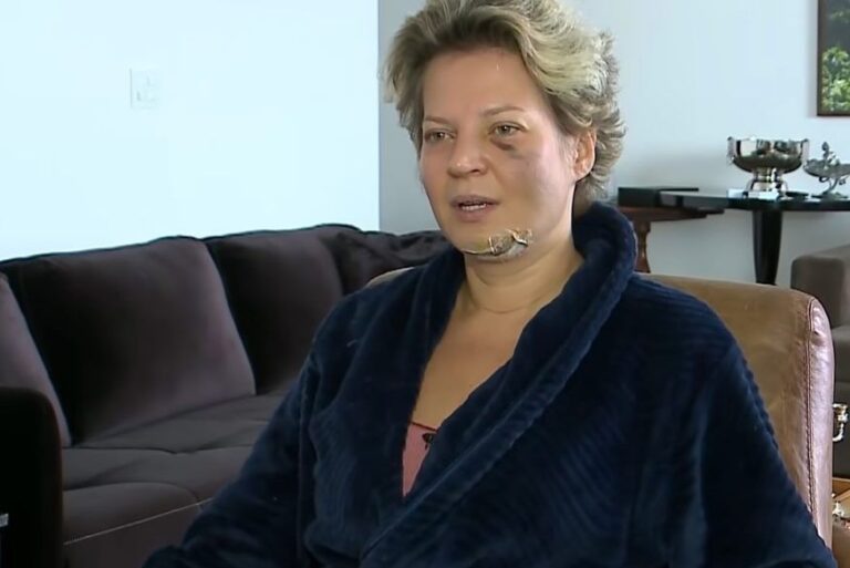 Joice Hasselmann: polícia do DF descarta agressão e diz que deputada caiu da própria altura