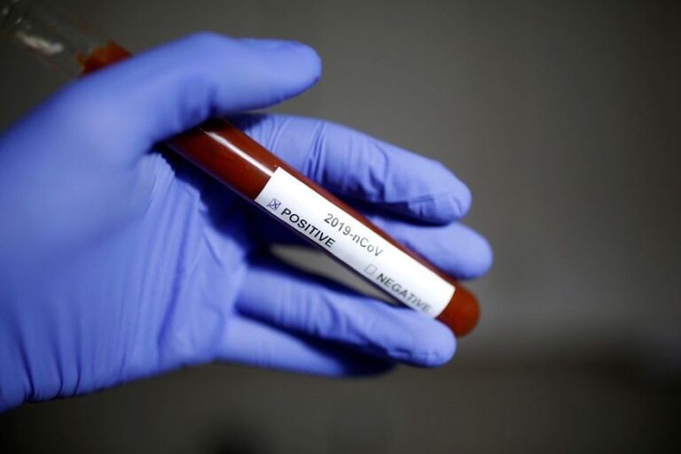 Brasil registra 281 mortes por Covid em 24 h e mai de 12 mil casos