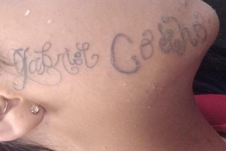 ‘Me sinto livre’, diz jovem ao remover tatuagem feita no rosto pelo ex-namorado ‘Me sinto livre’, diz jovem ao remover tatuagem feita no rosto pelo ex-namorado