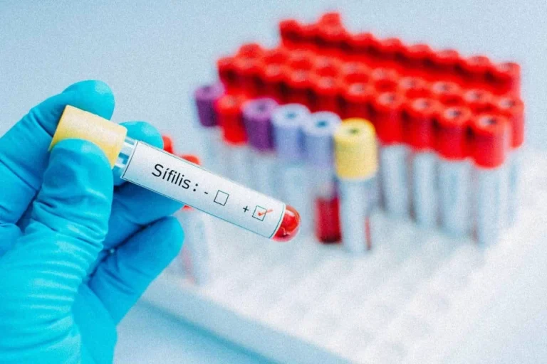 Onde surgiu a sífilis? DNA achado no Brasil pode ajudar na resposta