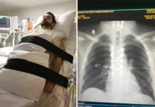 Anvisa libera pesquisa clínica da polilaminina, substância que pode regenerar lesão medular