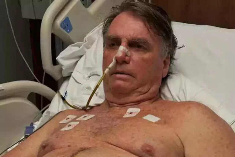 Médico confirma traumatismo craniano de Jair Bolsonaro após queda