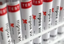 Prefeitura de João Pessoa desmente fake news sobre casos de Mpox no Ortotrauma